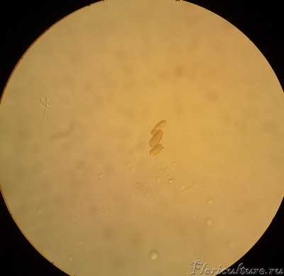 Вот группа из 3-х одноклеточных водорослей