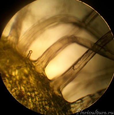 Ножки железок scorpioides. По краю видны недоразвитые железки.